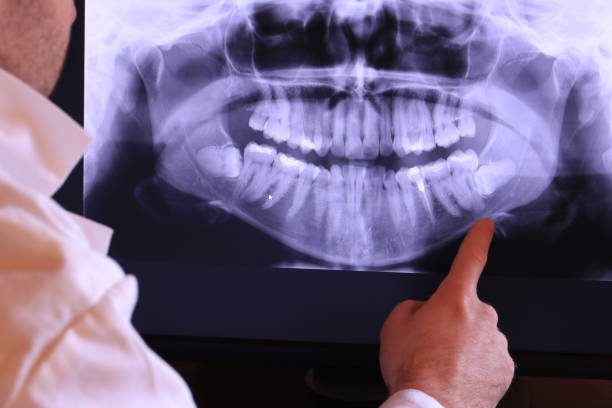 Best Emergency Gum Pain Relief  in Warrensville Heights, OH
