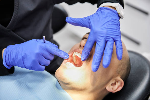 Best Teeth Whitening  in Warrensville Heights, OH