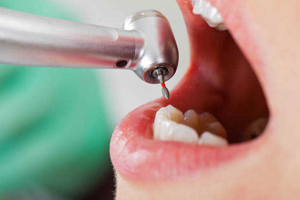 Best Root Canal Emergency Dentist  in Warrensville Heights, OH